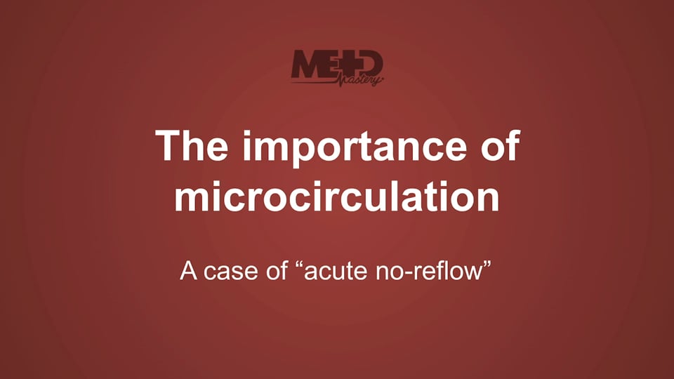 A case of “acute no-reflow”