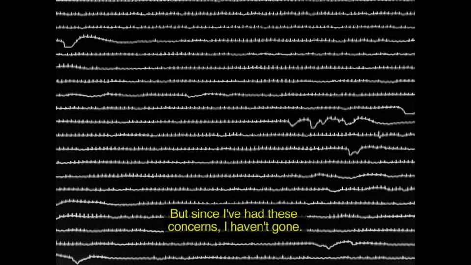 Arrhythmia
