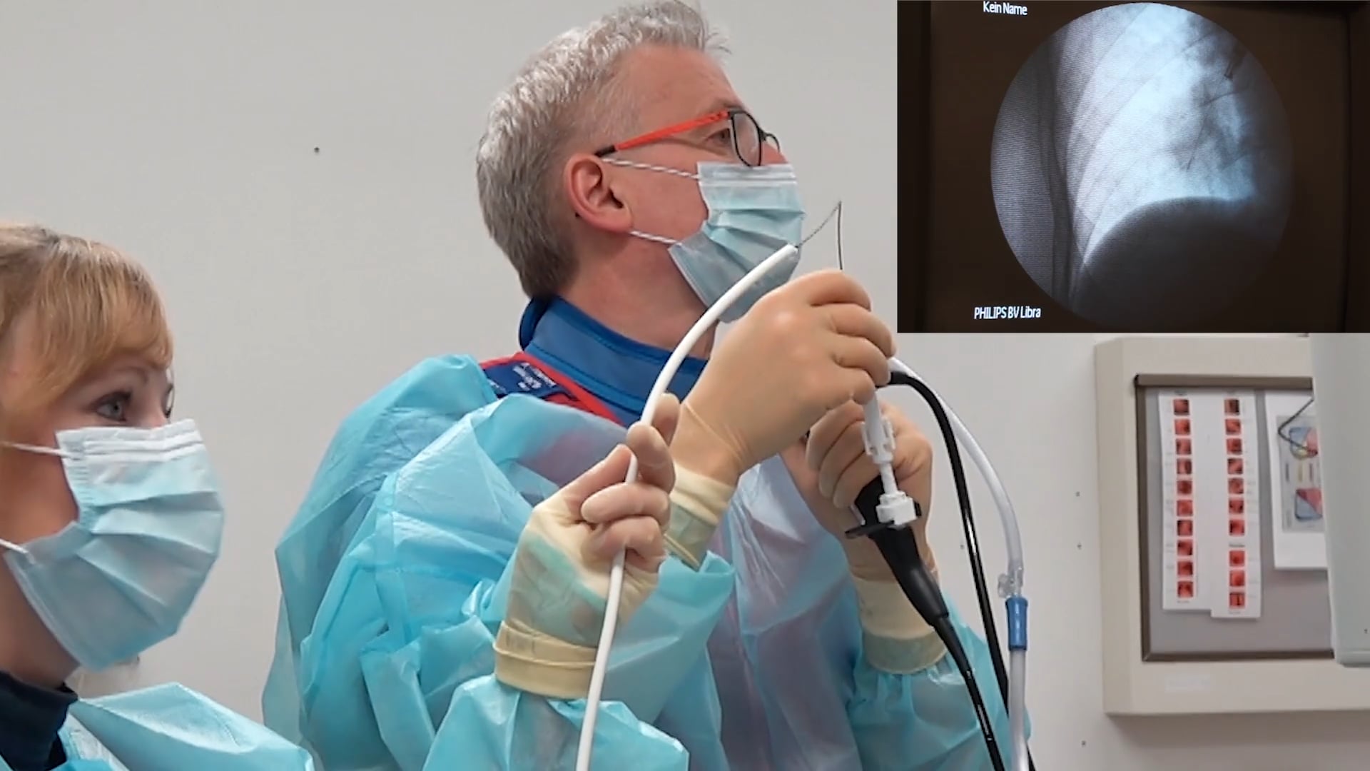 Transbronchial cryobiopsies using the 1.1 mm single-use probe with oversheath