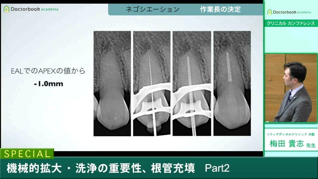 1 機械的洗浄と根管内洗浄【01/04-01/10 プレミアム会員視聴無料 