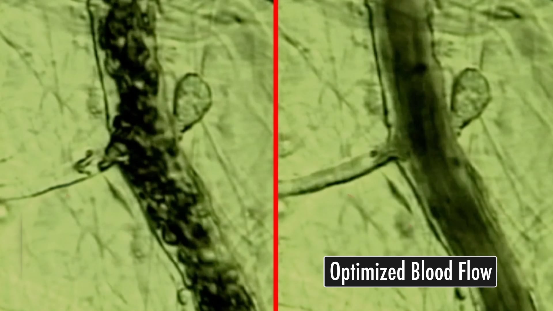 BEMER OPTIMIZED BLOOD FLOW