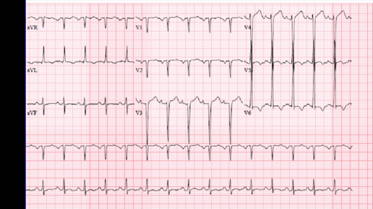 Hx COPD with Acute Dyspnea on Vimeo