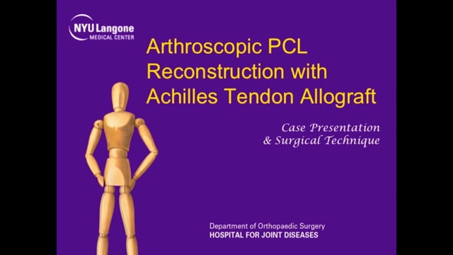 Arthroscopic PCL Reconstruction with Achilles Tendon Allograft