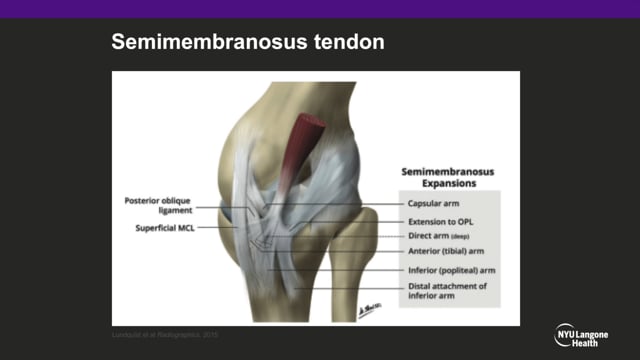 Demystifying the Posteromedial Corner of the Knee