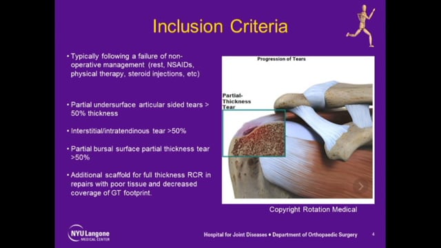 Rotator Cuff Repair Using Collagen Based Bioinductive Implant