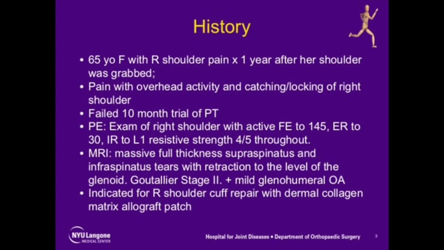 Arthroscopic Rotator Cuff Repair with Dermal Collagen Allograft Patch