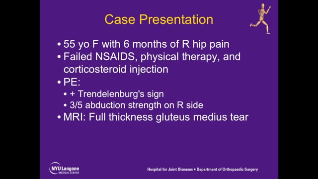 Endoscopic Gluteus Medius Repair