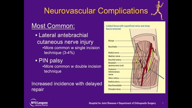 Distal Biceps Tendon Rupture Repair and Reconstruction