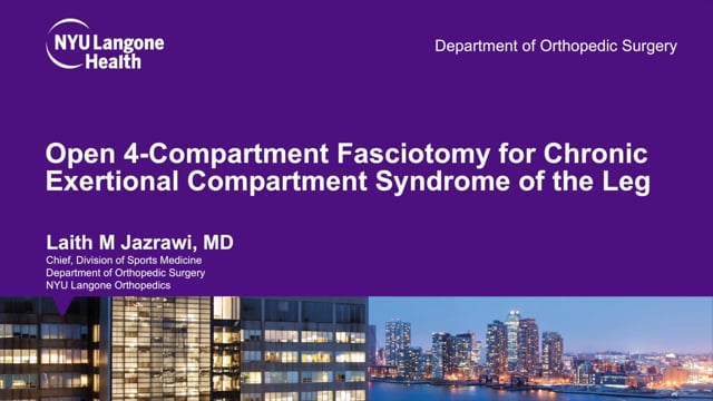 Open 4-Compartment Fasciotomy for Chronic Exertional Compartment Syndrome of the Leg