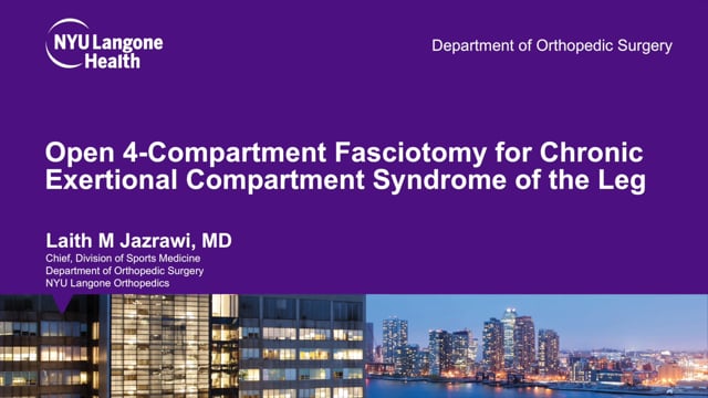 Open 4-Compartment Fasciotomy for Chronic Exertional Compartment Syndrome of the Leg