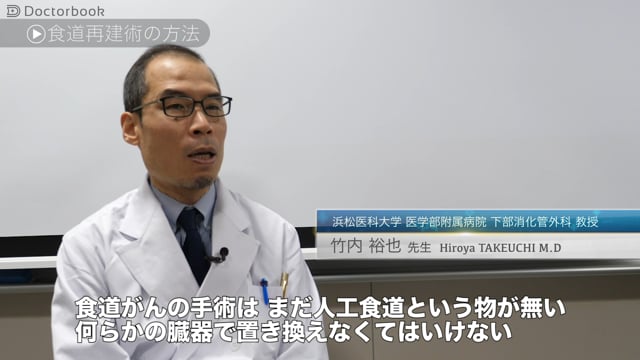 食道がんの再建術：人工食道はの利用は？再建に伴う合併症やその後の生活で注意するべきこと