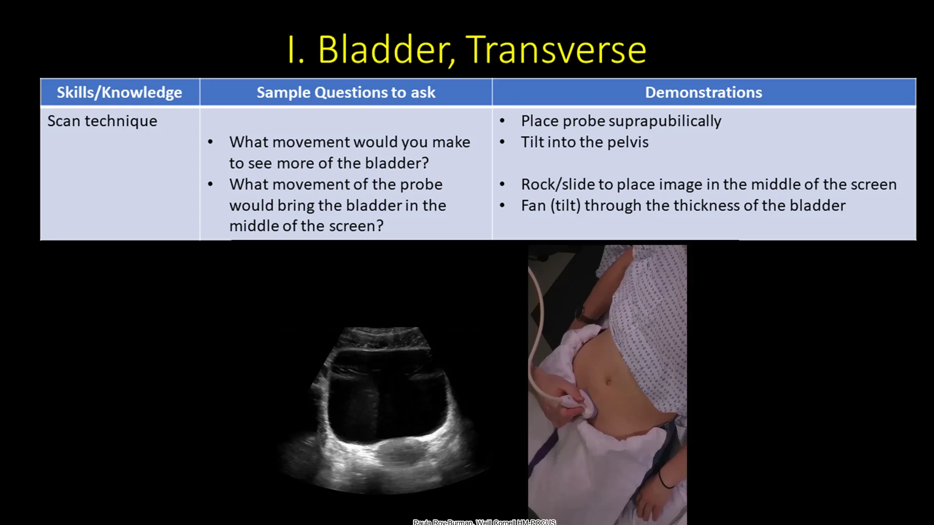 3. bladder transverse. technique + adjustements on Vimeo