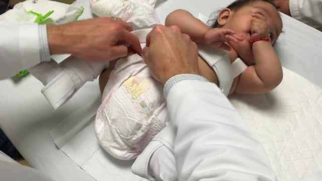 Changing a Diaper on a Child with a Pavlik Harness