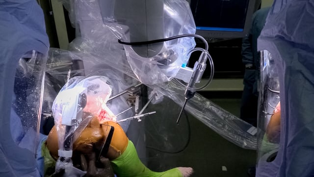 Active Robotic Total Knee Arthroplasty