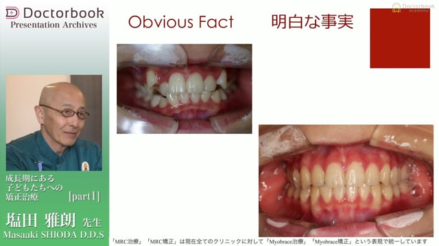 成長期にある子どもたちへの矯正治療