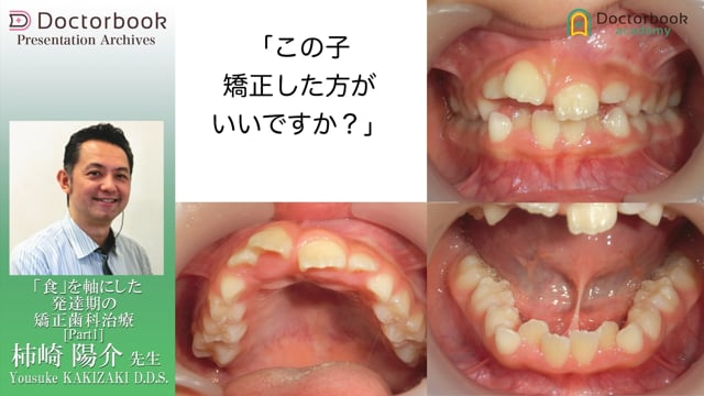 「食」を軸にした発達期の矯正治療