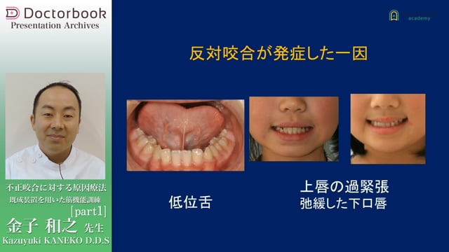 不正咬合に対する原因療法 〜既成装置を用いた筋機能訓練〜