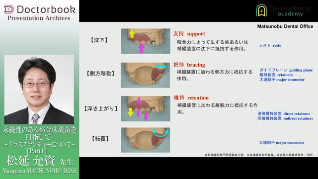 永続性のある部分床義歯を目指して 〜クラスプデンチャーについて〜