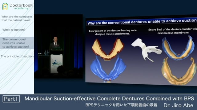 Mandibular Suction-effective Complete Dentures Combined with BPS