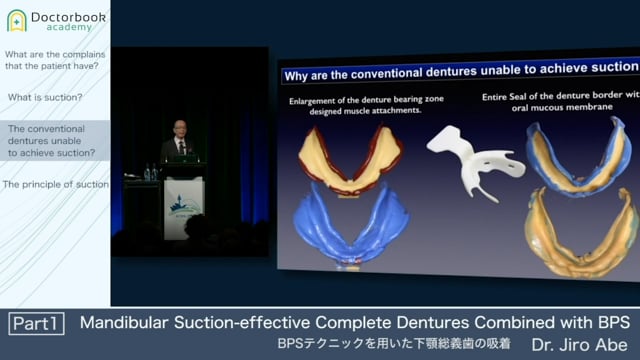 Mandibular Suction-effective Complete Dentures Combined with BPS #1