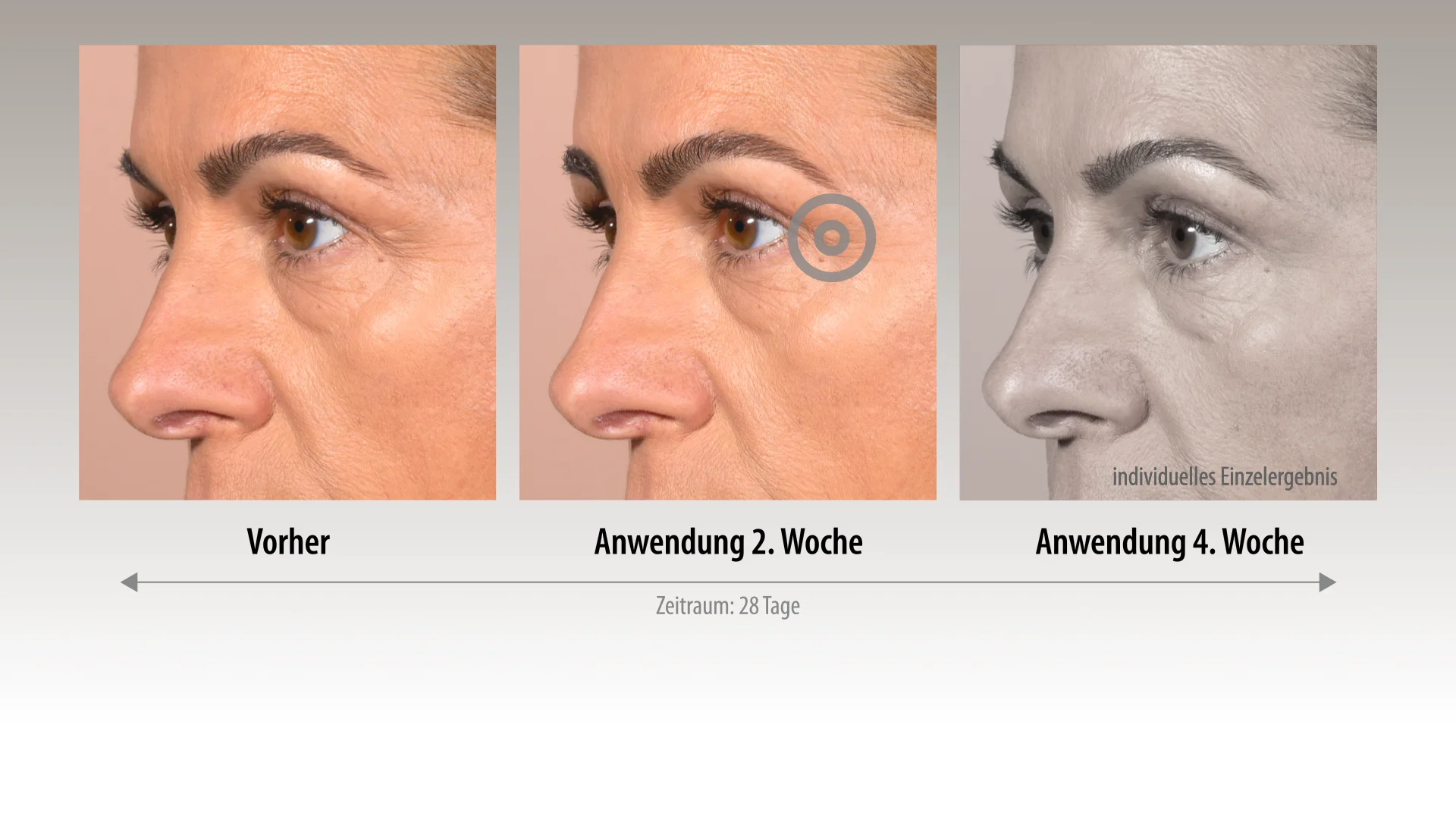 AND SHINE | THE YOUTH PATCH® | Anti-Aging Microneedling