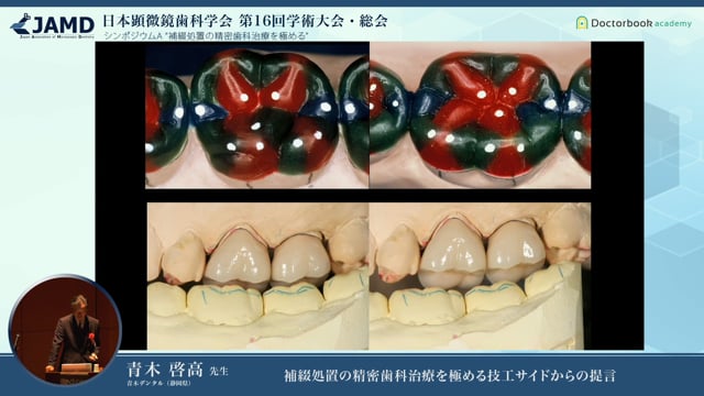 補綴処置の精密歯科治療を極める技工サイドからの提言 #2