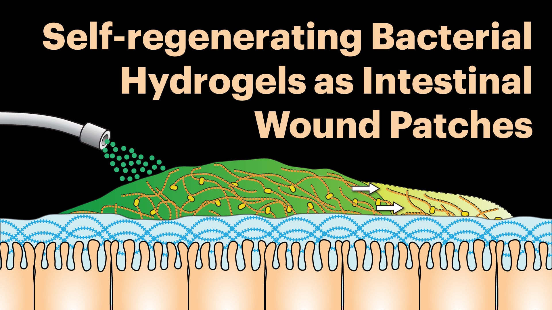 Self-regenerating bacterial hydrogels as intestinal wound patches