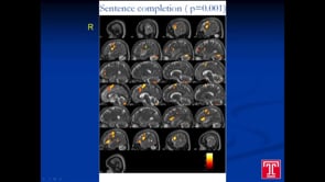 fMRI Case Conference with Scott H. Faro,  MD (5/10/13)