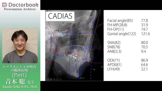 シークエンシャル咬合の臨床応用 | Doctorbook academy (ドクター 