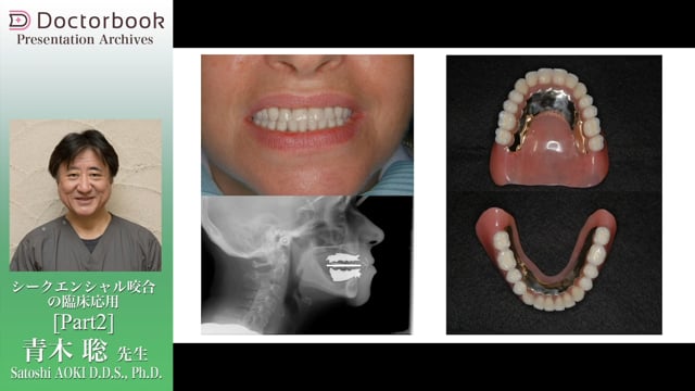 シークエンシャル咬合の臨床応用 | Doctorbook academy (ドクター 