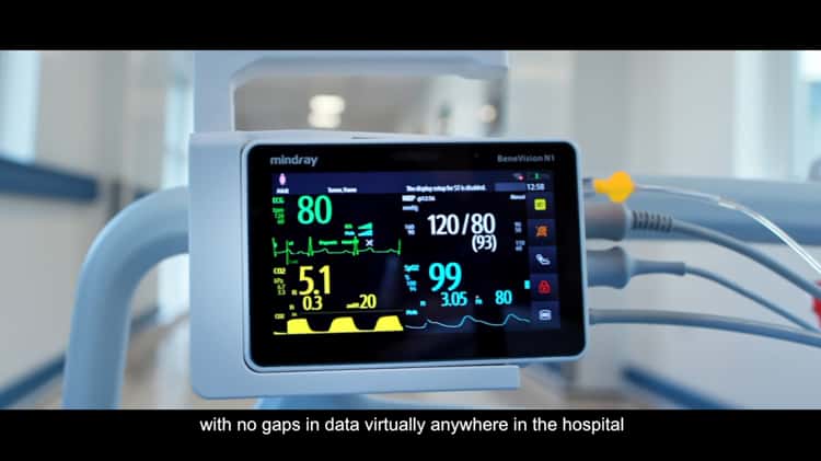 What Can We Do With These Patient Monitor Videos?