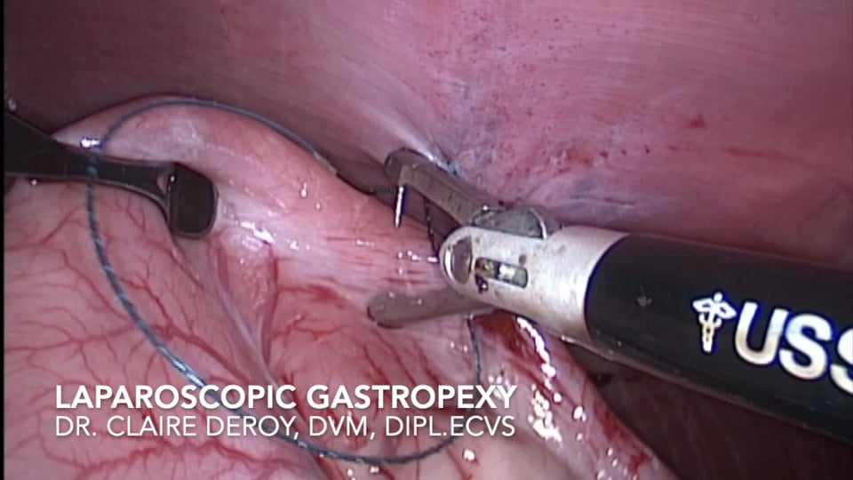 Simplified Laparoscopic Gastropexy video