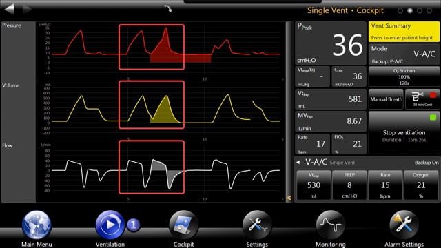 Patient-Ventilator Interactions with the ASL 5000 Breathing Simulator ...