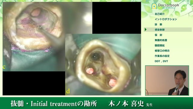 歯内療法 成功への道 抜髄 Initial Treatment 治癒に導くため… 健康