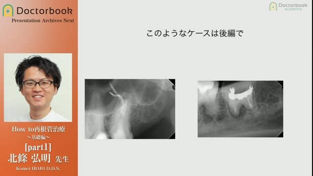 How to 再根管治療 〜基礎編〜