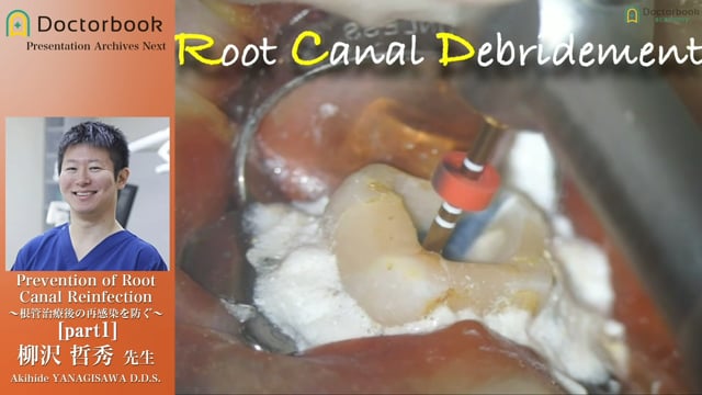 Prevention of Root Canal Reinfection 〜根管治療後の再感染を防ぐ〜（2018年版）
