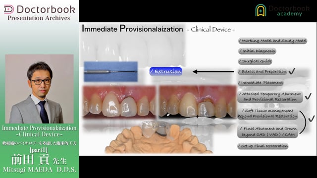 Immediate Provisionalaization -Clinical Device-