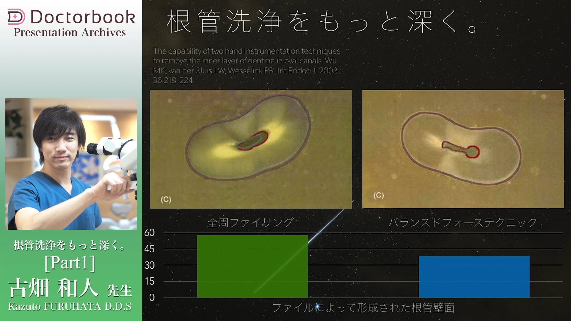 #1 根管洗浄の存在意義