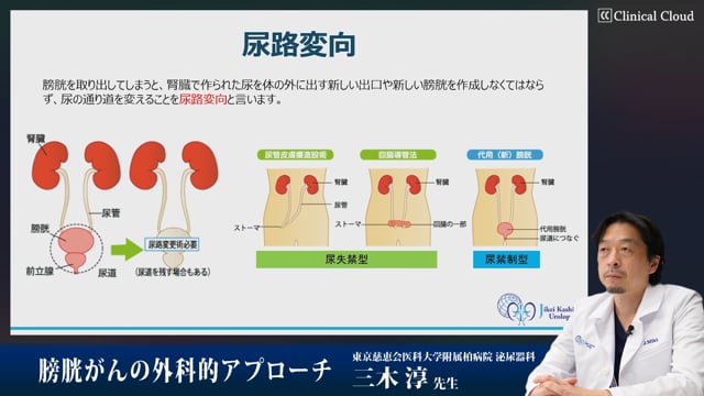 膀胱癌の外科的アプローチ