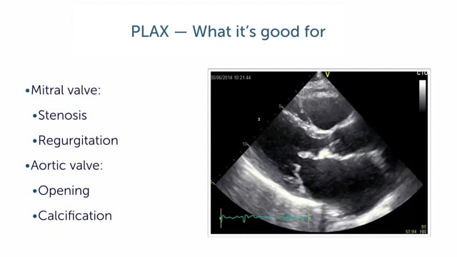 Which pathologies can I find in the PLAX view?