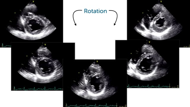 How can I scan the entire ventricle in a PSAX?