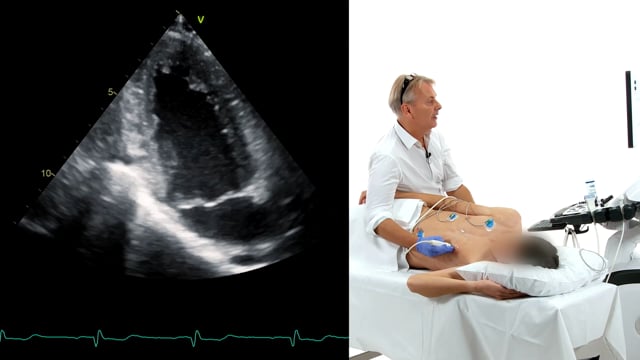 How can I use the patient's breathing to optimize an image?