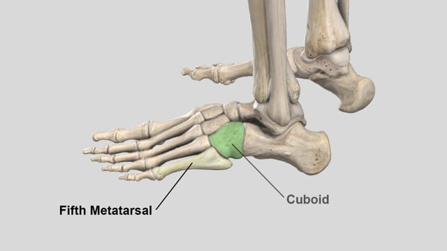 Fifth Metatarsal (Jones) Fractures: Review and Surgical Technique for Intramedullary Screw Fixation