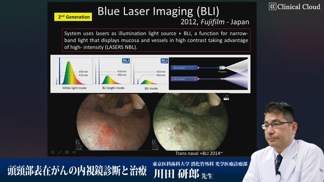 川田 研郎先生：頭頸部表在がんの内視鏡診断と治療