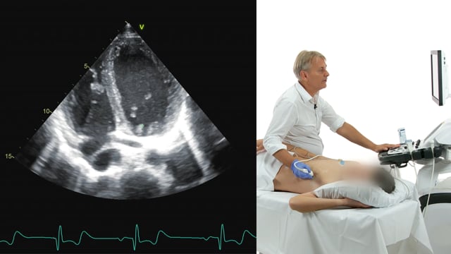 How can I perform a coronary sinus view?