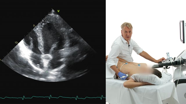 Can I see the pulmonic veins in an apical view?