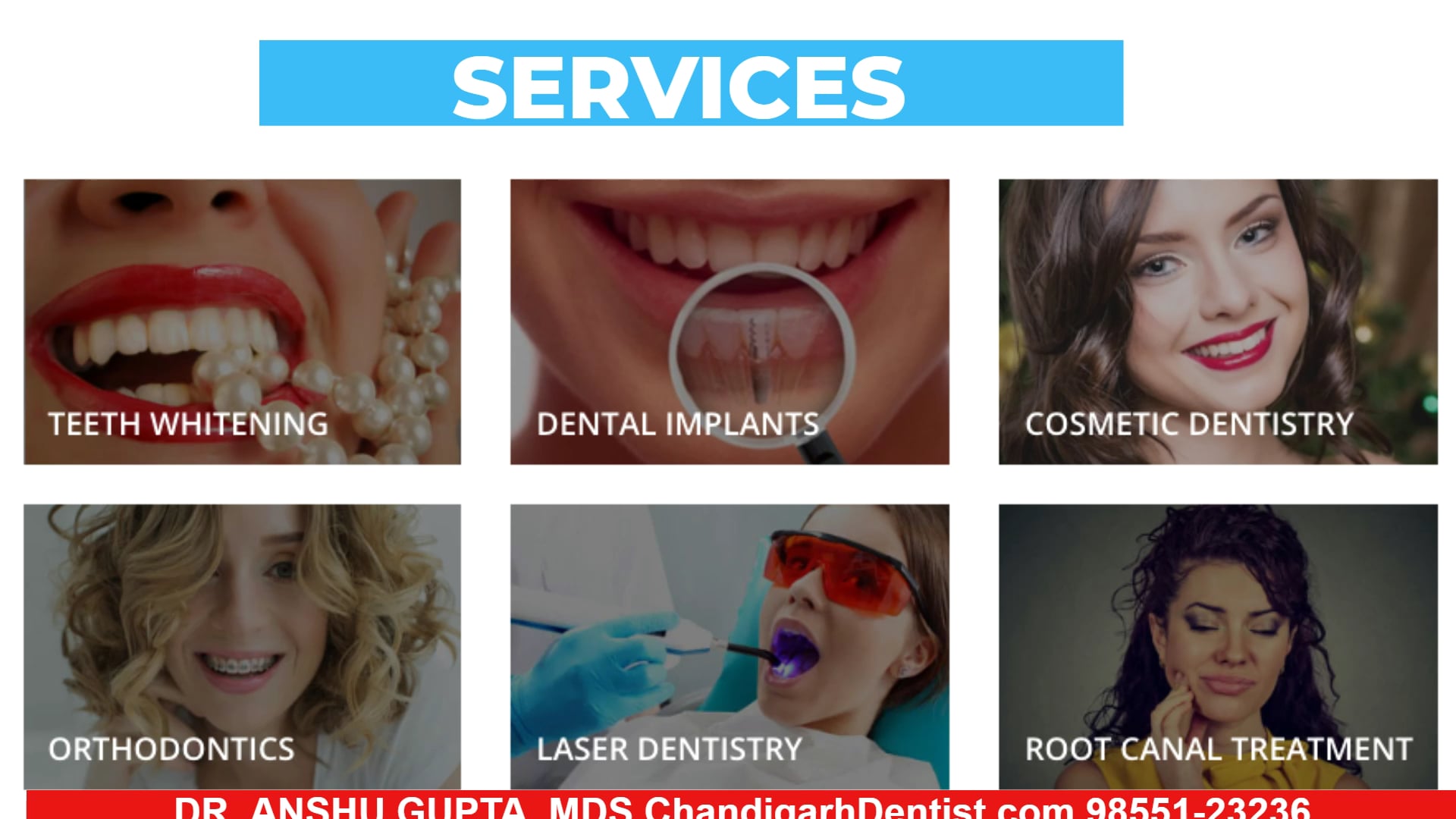 Orthodontics & Dental Braces Teeth Straightening Chandigarh Top