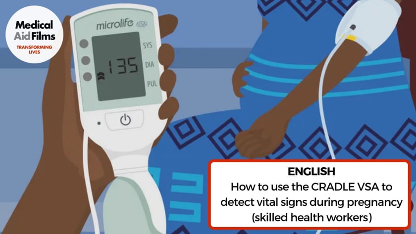 Microlife Cradle VSA Blood Pressure Monitor - CRIBS