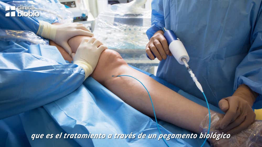 operaiunea de medicina varicoza)