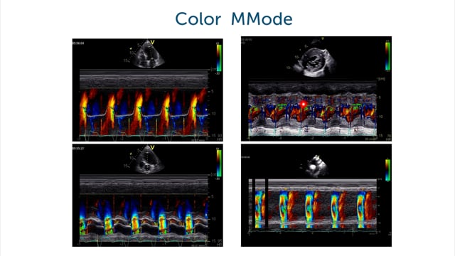 Why should I use color M-Mode?